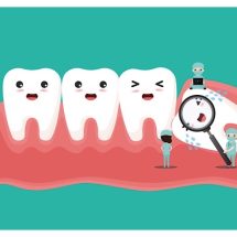 ผ่าฟันคุด กินอะไรได้บ้าง ดูแลยังไง